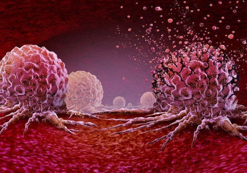 First Use of Click Chemistry in Humans Safely Treats Cancer 1 First Use of Click Chemistry in Humans Safely Treats Cancer