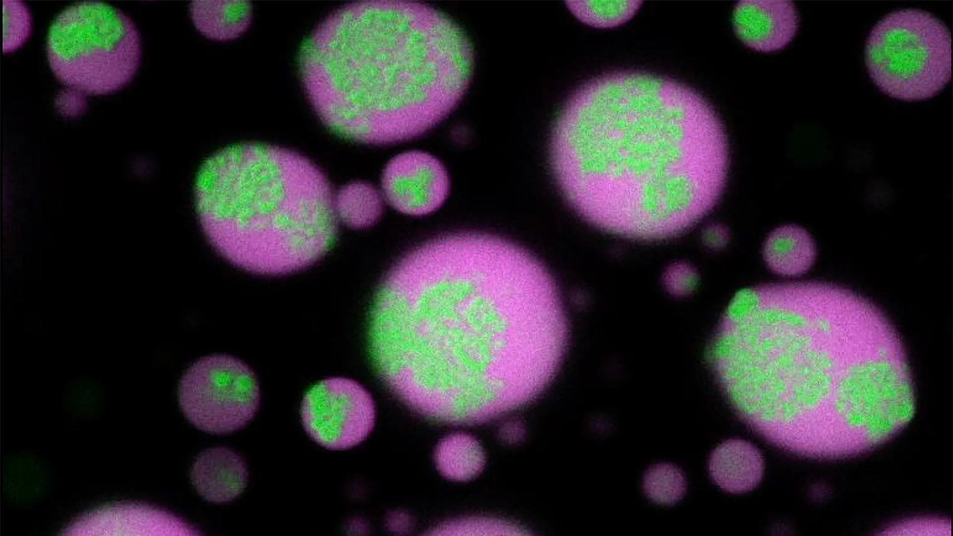 Scientists crack the mystery of brain cell clumps, and make them vanish 1 Scientists crack the mystery of brain cell clumps, and make them vanish