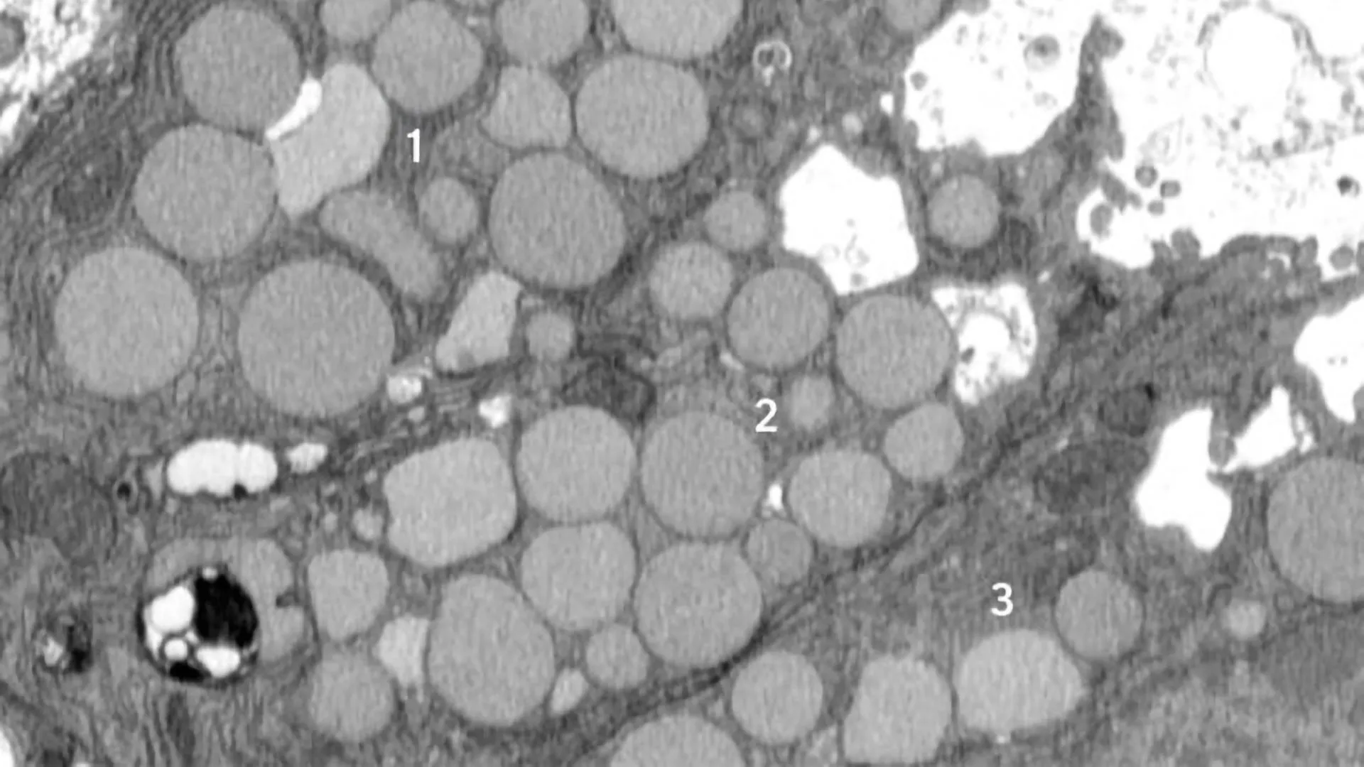 Cells “vomit” waste in a hidden healing shortcut that could also fuel cancer 1 Cells “vomit” waste in a hidden healing shortcut that could also fuel cancer