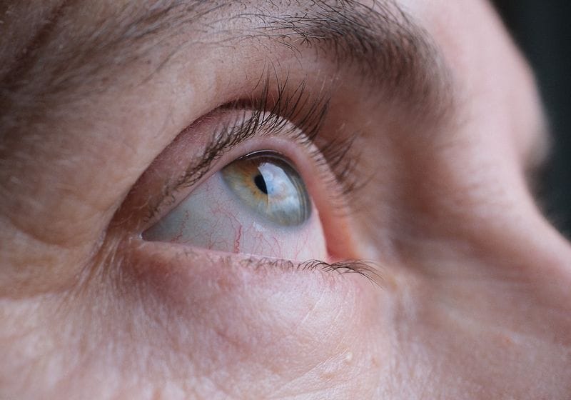 Electric Bursts Reshape the Cornea to Improve Eyesight Without LASIK 1 Electric Bursts Reshape the Cornea to Improve Eyesight Without LASIK