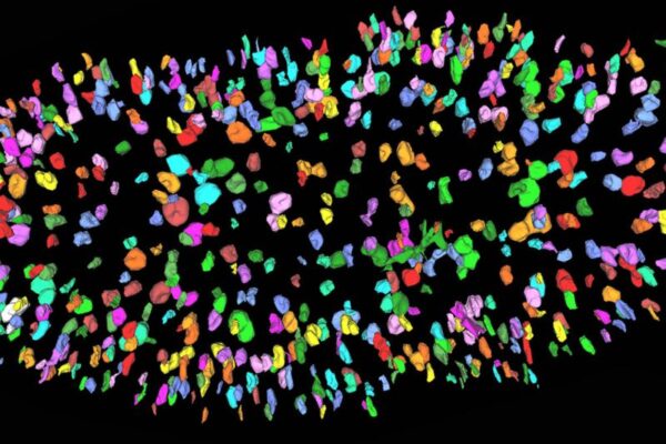 Estrogen Shields Kidneys from Chronic Disease