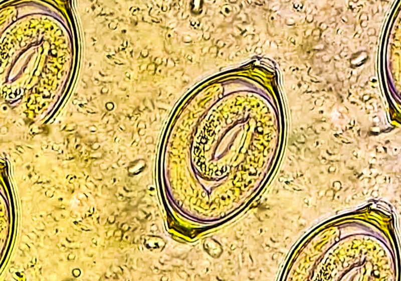 How Whipworms Tunnel Through the Gut 1 How Whipworms Tunnel Through the Gut