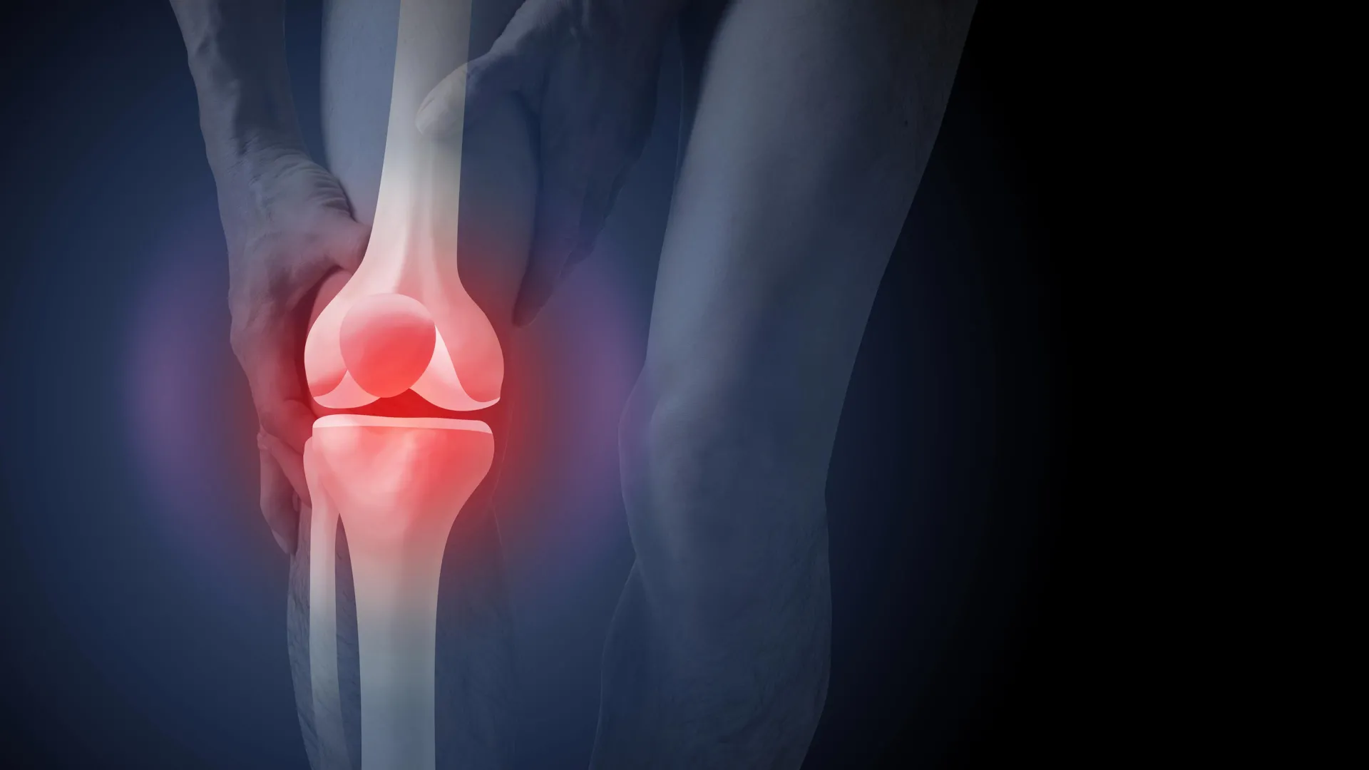The surprising reason x-rays can push arthritis patients toward surgery 1 The surprising reason x-rays can push arthritis patients toward surgery
